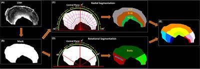 Tractography of Porcine Meniscus Microstructure Using High-Resolution Diffusion Magnetic Resonance Imaging